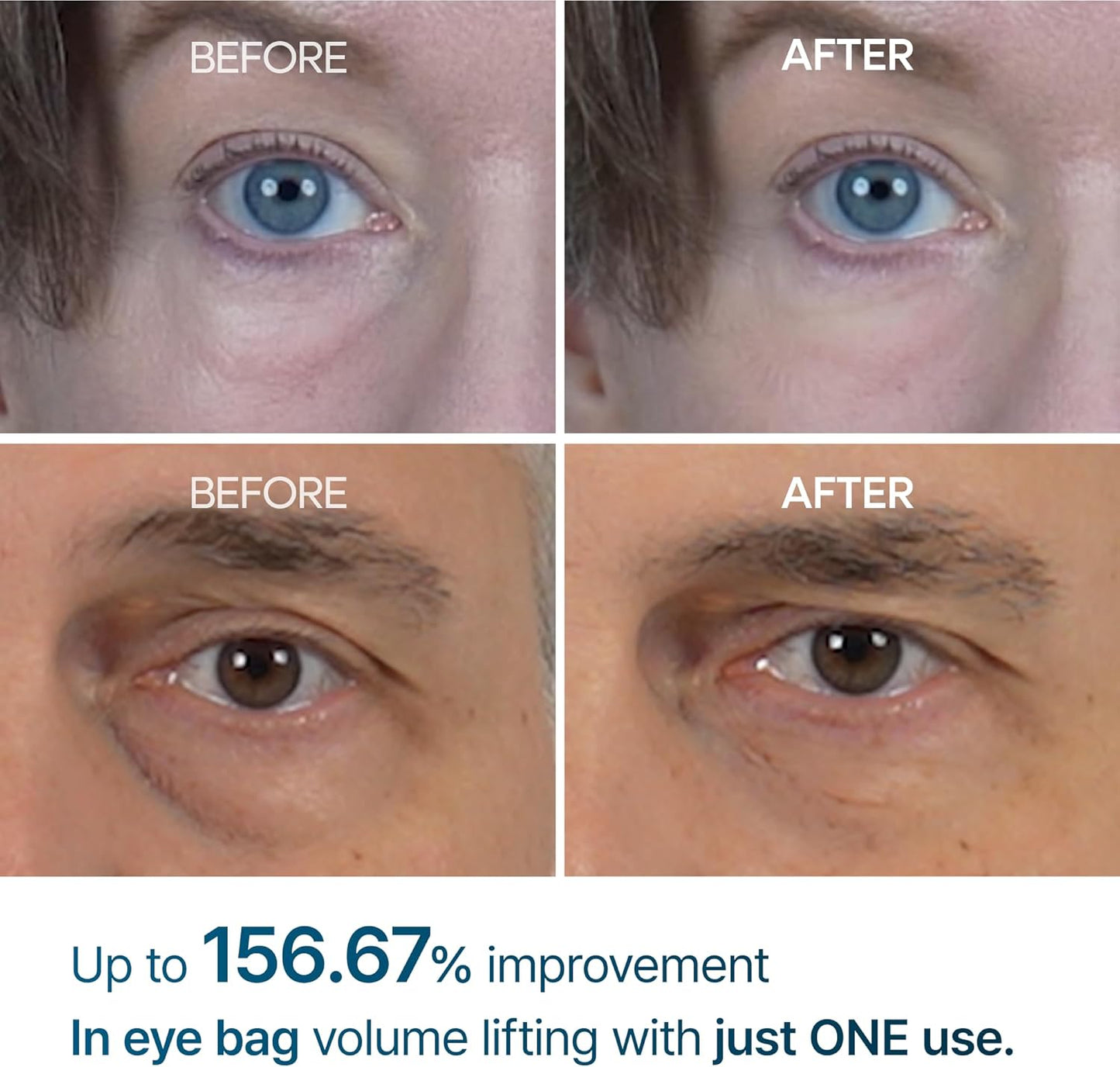 Dr.Melaxin Eyephalt Eyebag Cream | كريم دكتور ميلاكسين آيفالت لعلاج انتفاخات تحت العين