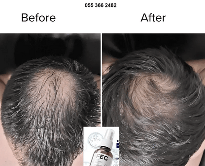 Hair Growth Spray PLUS